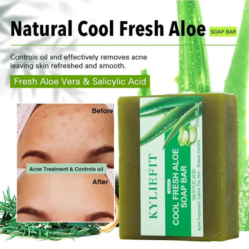 AILKE Aloe Vera Whitening Soap, Remove Acne, Pimples, Skin Radiant, Improve Skin Luster, Vegan Bath Wash for Women Men - Image 3