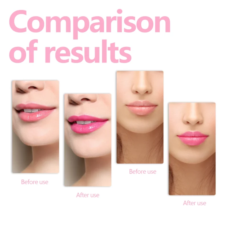 EELHOE Color Changing Lip Oil Transparent Lip Gloss Oil Lip Balm Color Changing Lip Oil Chapped Lip Care Moisturizer - Image 2